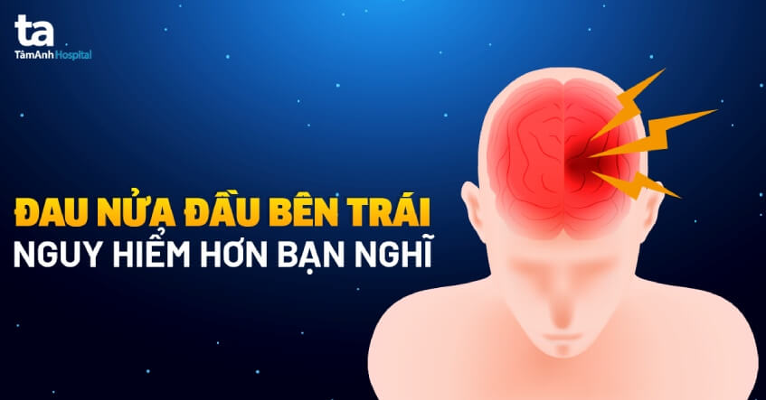 Đau nửa đầu trái là bệnh gì